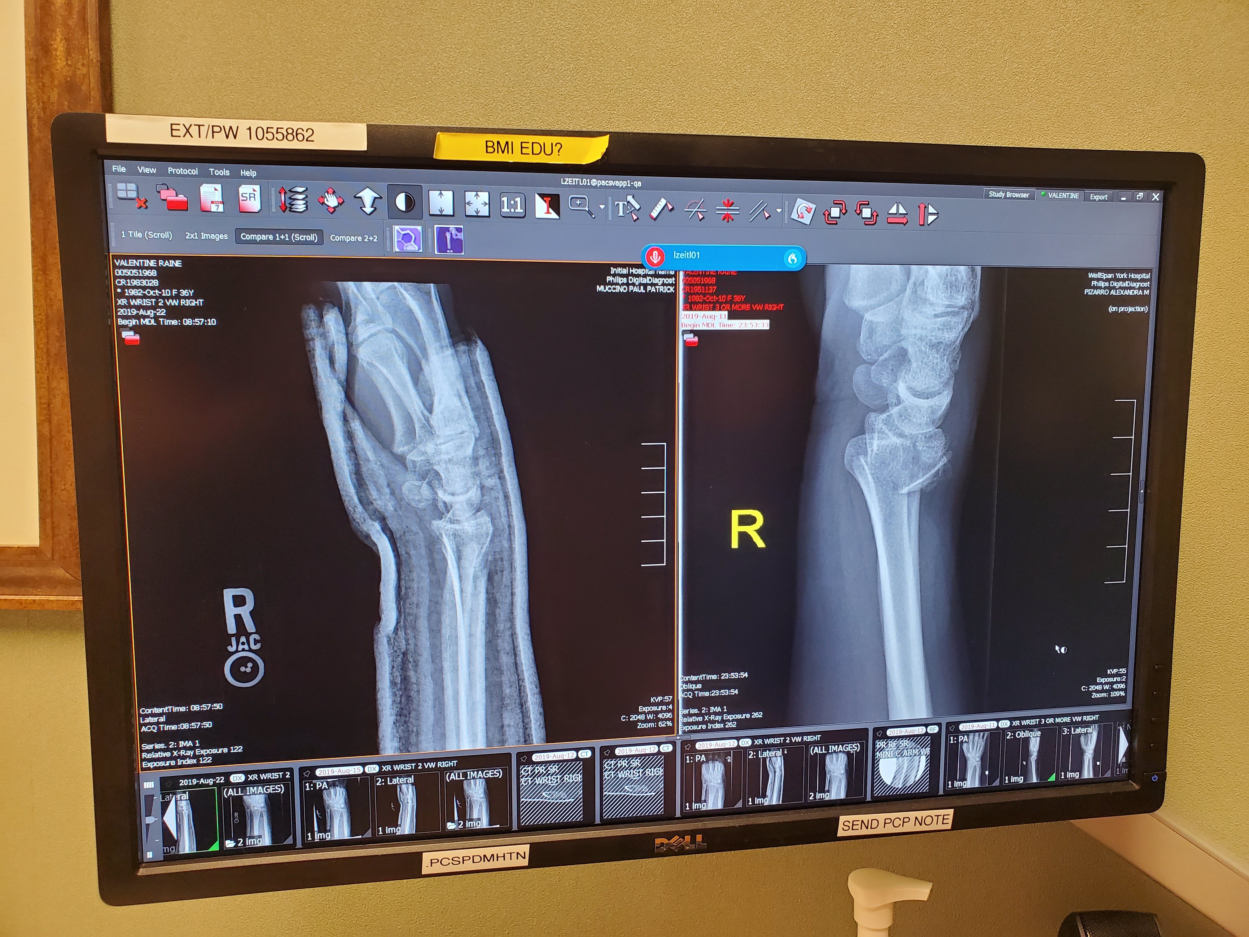 Week 1 – Ambidextrous